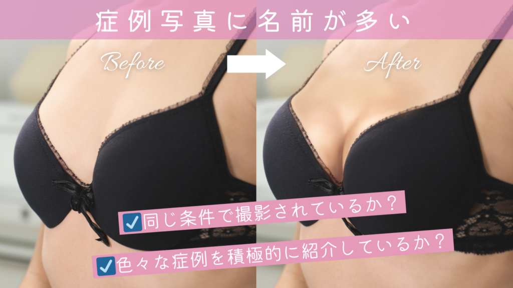 症例写真が多いかどうか？