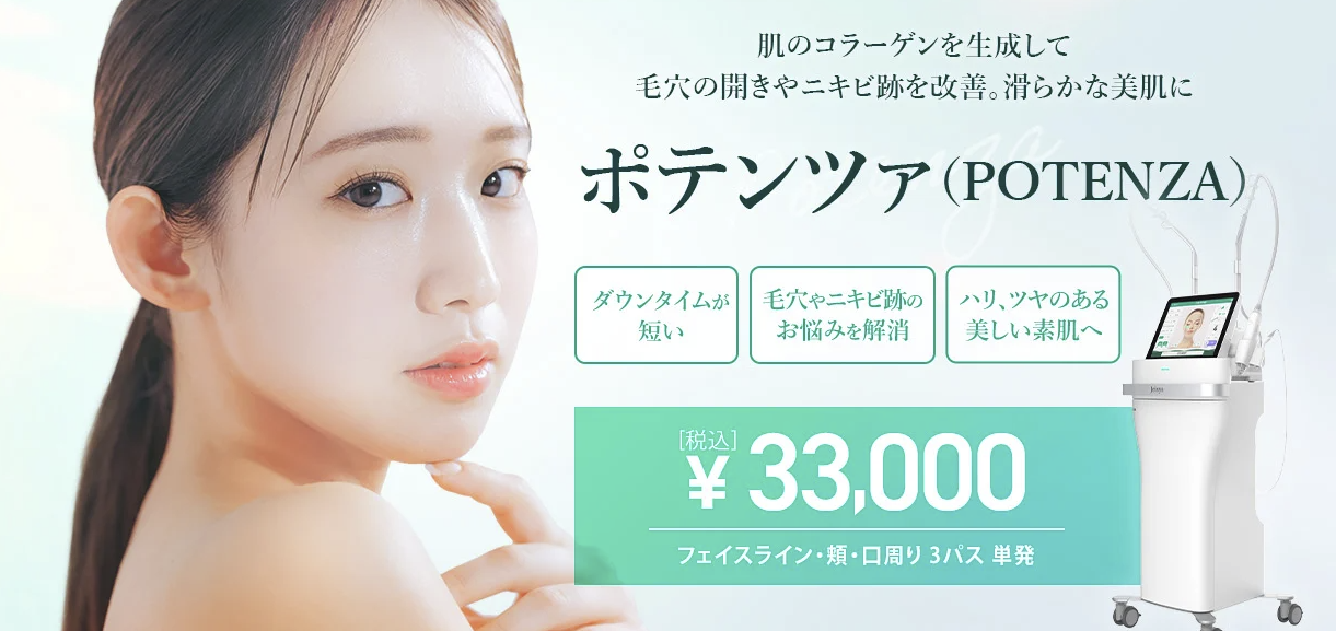 TCBポテンツァ