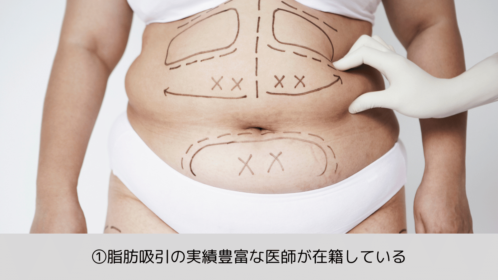 ポイント1