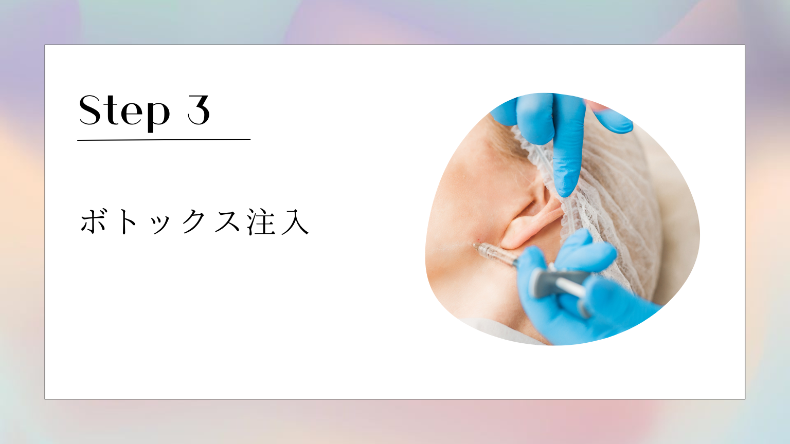 湘南美容クリニックエラボトックス施術フローStep3