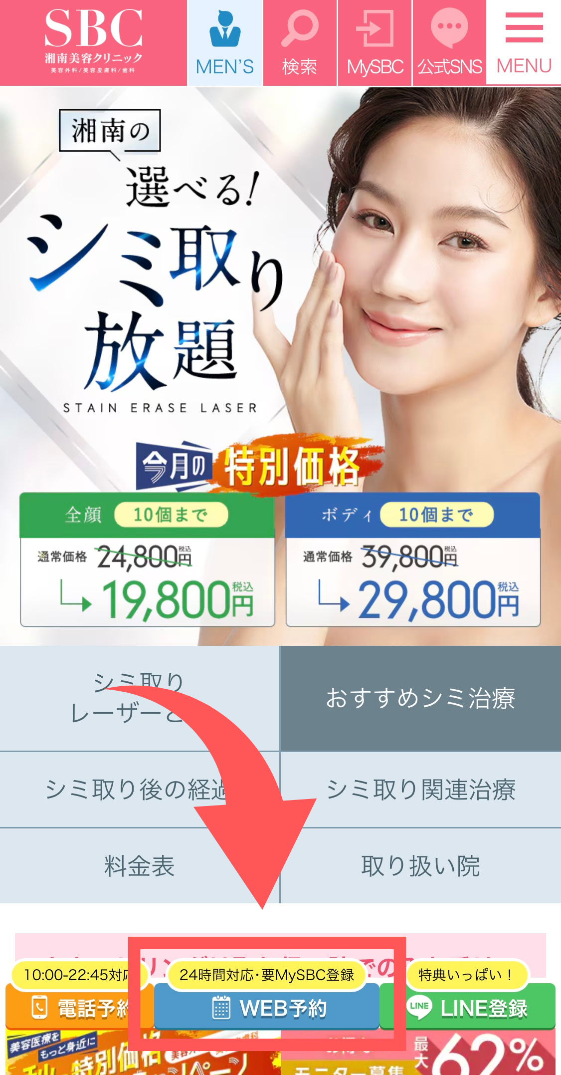 湘南美容クリニックシミ取り予約方法