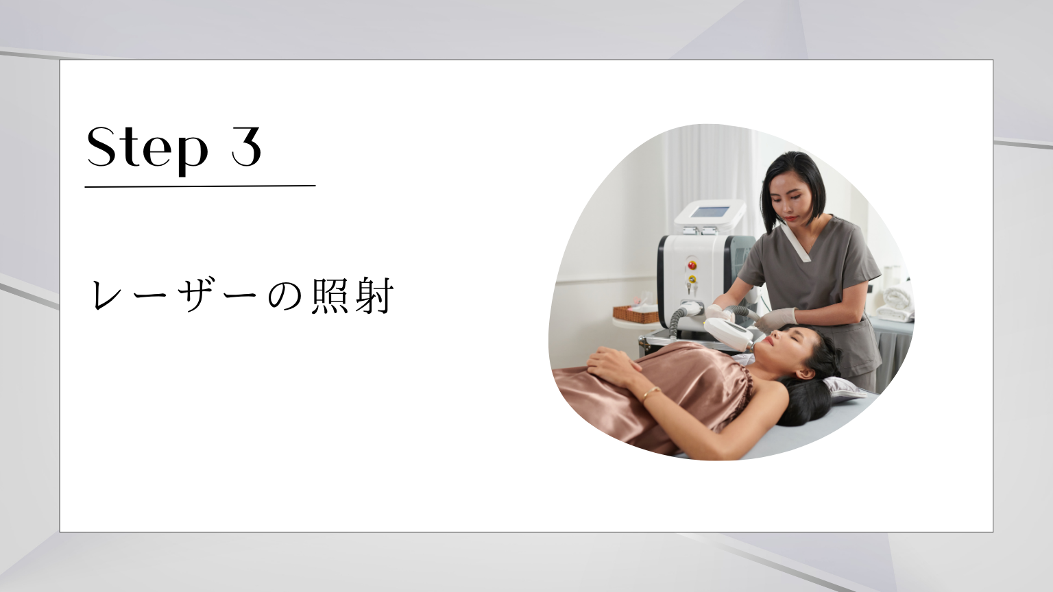 レーザーの照射